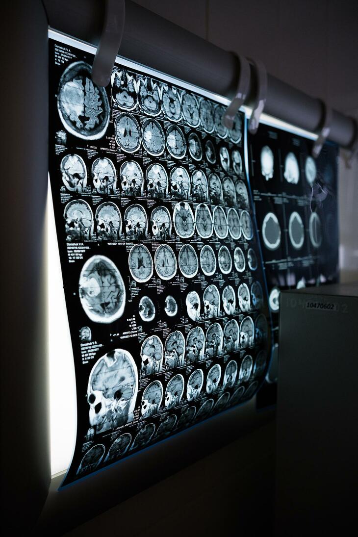 Illustrasjonsbilde av CT-scanning