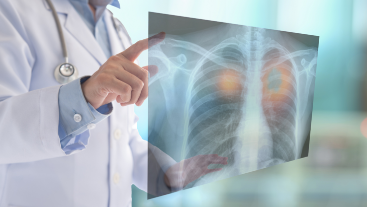 Bilde av lege som ser på røntgenbilde